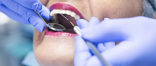 Best Emergency Gum Treatment in Rock Hill, SC